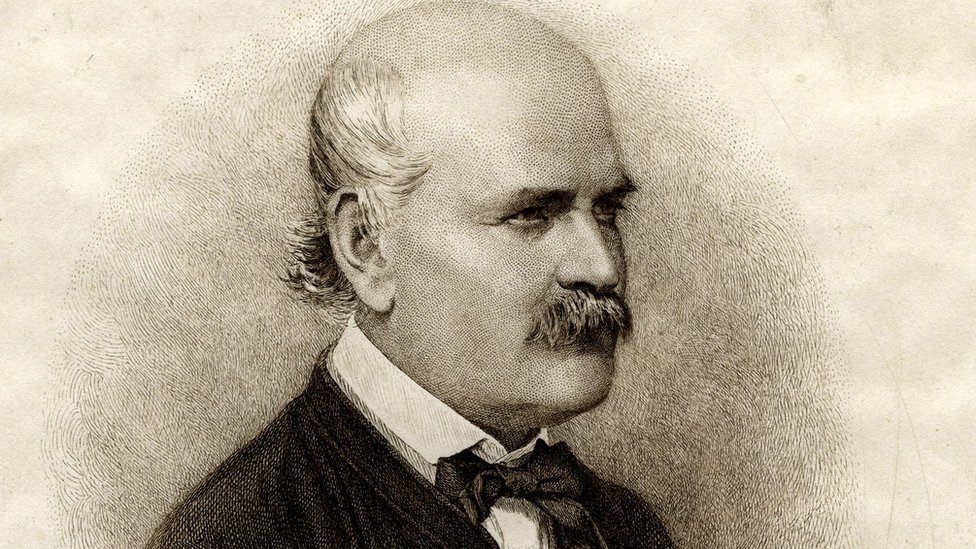 Febre Puerperal: Entendendo a Doença que Semmelweis Combateu