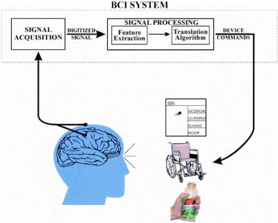 Neuralink vs Synchron: Comparativo das Interfaces Cérebro-Computador